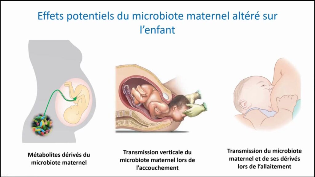 Effets potentiels du microbiote maternel altéré sur l’enfant