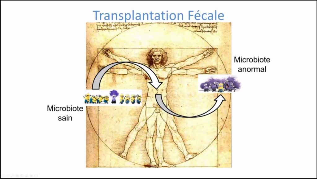 Transplantation fécale